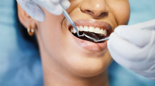 Best Emergency Dentist for Lost Fillings or Crowns in Fort Rucker, AL